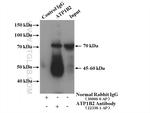 ATP1B2 Antibody in Immunoprecipitation (IP)