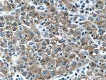 L-VEGFA Antibody in Immunohistochemistry (Paraffin) (IHC (P))