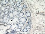 CCL17 Antibody in Immunohistochemistry (Paraffin) (IHC (P))