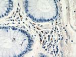 CCL17 Antibody in Immunohistochemistry (Paraffin) (IHC (P))