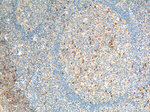 CCR3 Antibody in Immunohistochemistry (Paraffin) (IHC (P))