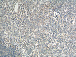 CCR3 Antibody in Immunohistochemistry (Paraffin) (IHC (P))