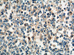 CCR3 Antibody in Immunohistochemistry (Paraffin) (IHC (P))