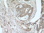 MIG Antibody in Immunohistochemistry (Paraffin) (IHC (P))