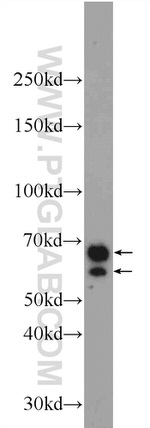 CXorf15 Antibody in Western Blot (WB)