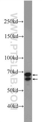 CXorf15 Antibody in Western Blot (WB)