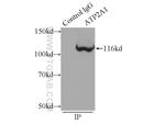 ATP2A1 Antibody in Immunoprecipitation (IP)