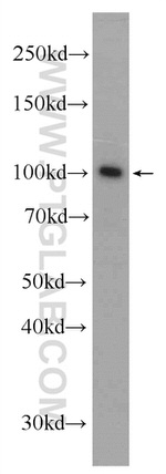 BRCA1 Antibody in Western Blot (WB)