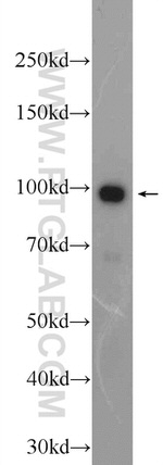 BRCA1 Antibody in Western Blot (WB)