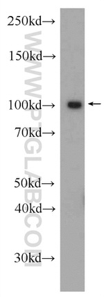 BRCA1 Antibody in Western Blot (WB)