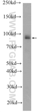 BRCA1 Antibody in Western Blot (WB)