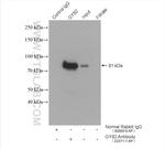 GYS2 Antibody in Immunoprecipitation (IP)