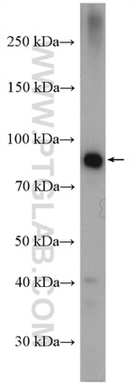 GYS2 Antibody in Western Blot (WB)