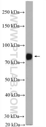 GYS2 Antibody in Western Blot (WB)