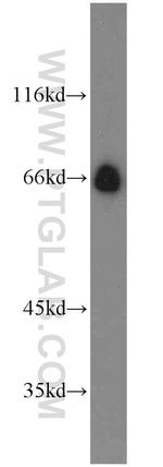 DCP1A Antibody in Western Blot (WB)