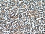 IRF7 Antibody in Immunohistochemistry (Paraffin) (IHC (P))