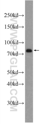 IRF7 Antibody in Western Blot (WB)