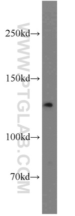 MSH3 Antibody in Western Blot (WB)