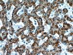 AGXT Antibody in Immunohistochemistry (Paraffin) (IHC (P))