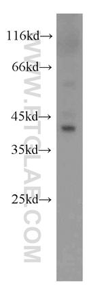 AGXT Antibody in Western Blot (WB)