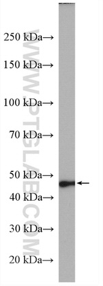 AGXT Antibody in Western Blot (WB)