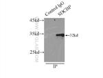 Syntenin-1 Antibody in Immunoprecipitation (IP)