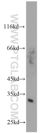 Syntenin-1 Antibody in Western Blot (WB)