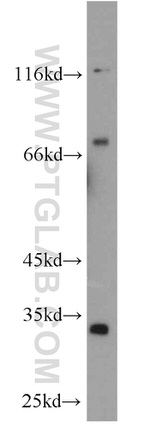 Syntenin-1 Antibody in Western Blot (WB)