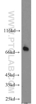 ACSL4/FACL4 Antibody in Western Blot (WB)