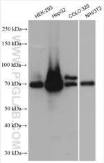 ACSL4/FACL4 Antibody in Western Blot (WB)