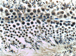 Casein Kinase 2 beta Antibody in Immunohistochemistry (Paraffin) (IHC (P))