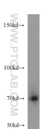 ADRA1B Antibody in Western Blot (WB)