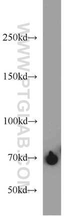 ADRA1B Antibody in Western Blot (WB)