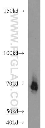 ADRA1B Antibody in Western Blot (WB)