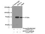 HNF1A Antibody in Immunoprecipitation (IP)