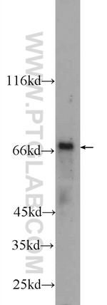 HNF1A Antibody in Western Blot (WB)