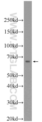 HNF1A Antibody in Western Blot (WB)