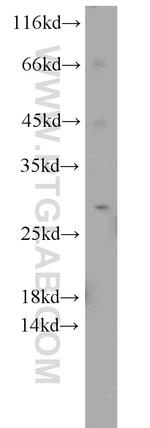 SIKE1 Antibody in Western Blot (WB)