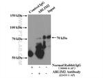 ABLIM2 Antibody in Immunoprecipitation (IP)