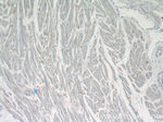 ERBB2IP Antibody in Immunohistochemistry (Paraffin) (IHC (P))