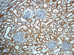 ERBB2IP Antibody in Immunohistochemistry (Paraffin) (IHC (P))