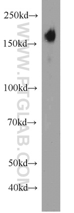 ERBB2IP Antibody in Western Blot (WB)