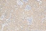 ERBB2IP Antibody in Immunohistochemistry (Paraffin) (IHC (P))