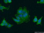 ERBB2IP Antibody in Immunocytochemistry (ICC/IF)