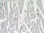 ERBB2IP Antibody in Immunohistochemistry (Paraffin) (IHC (P))