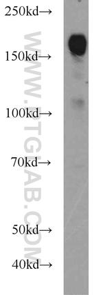 ERBB2IP Antibody in Western Blot (WB)