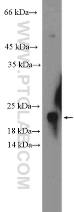 GABARAP Antibody in Western Blot (WB)