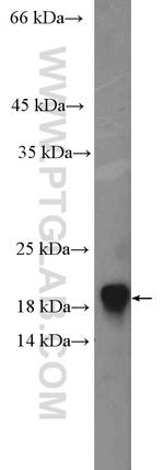 GABARAP Antibody in Western Blot (WB)