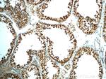 LARG Antibody in Immunohistochemistry (Paraffin) (IHC (P))