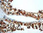 LARG Antibody in Immunohistochemistry (Paraffin) (IHC (P))